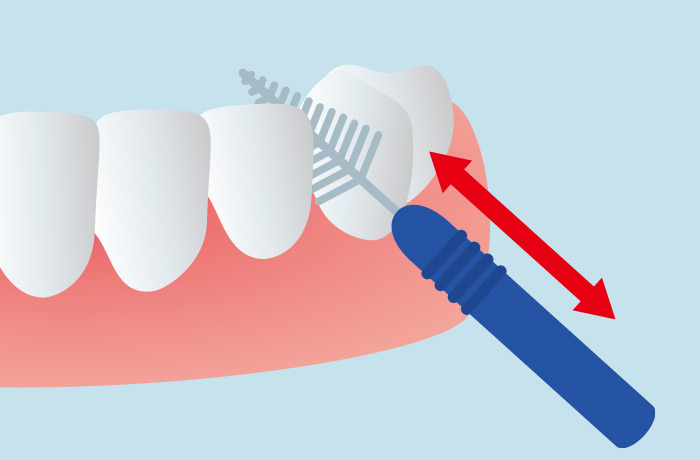 歯間ブラシのイラスト